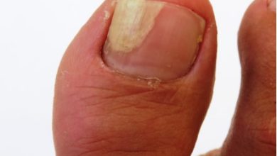 What Are the Common Causes of Pus Under the Toenail