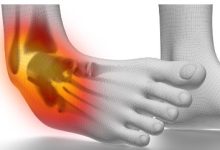 Where to Get the Best Lateral Ankle Ligament Pain Treatment