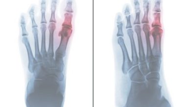 Why is the Metatarsophalangeal Joint Important